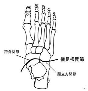 足首 捻挫 立方骨の構造理解:横足根関節(踵立方関節と距舟関節)の位置を示す足の骨格図