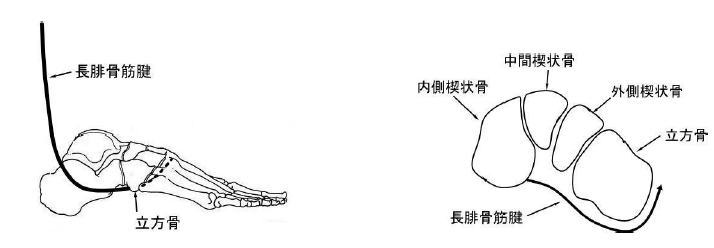 足首 捻挫 立方骨のズレのメカニズム:長腓骨筋腱と立方骨の位置関係を示す解剖図